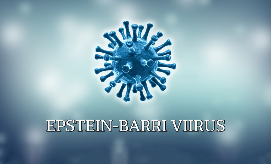 Epstein-Barri Viirus
